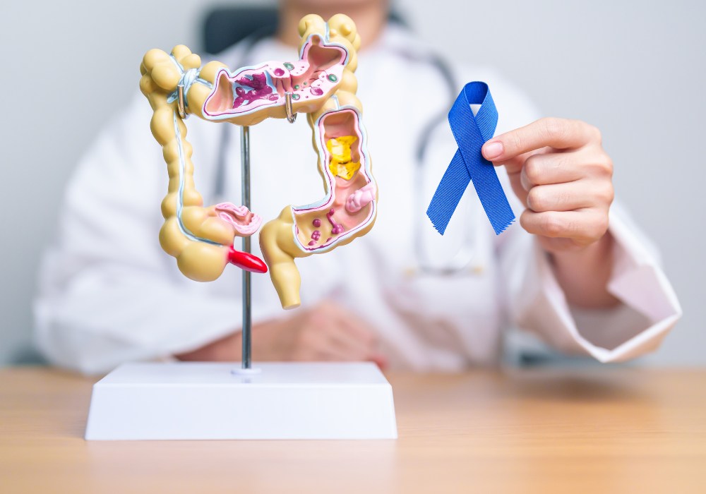 大腸カメラ検査(下部消化管内視鏡検査)