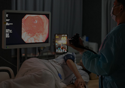 高精度スコープで小さな病変も早期発見