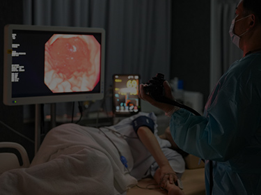 高精度スコープで小さな病変も早期発見