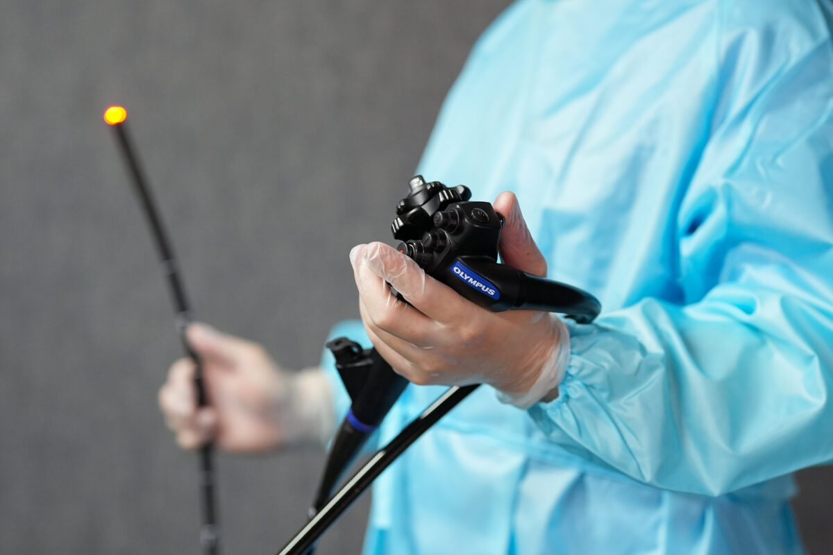 高精度スコープで小さな病変も早期発見